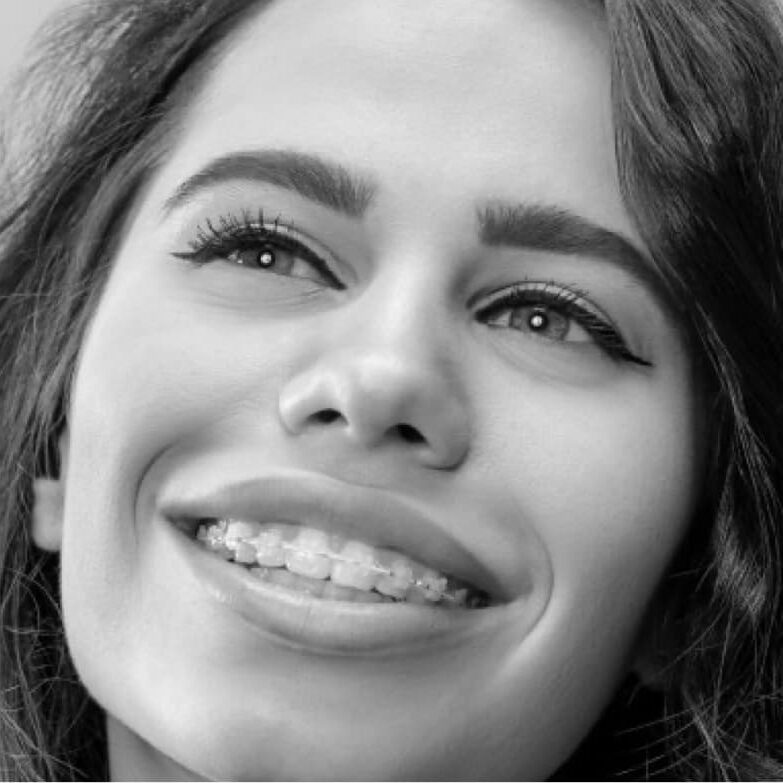 treatment-clear-braces Biloxi Orthodontist