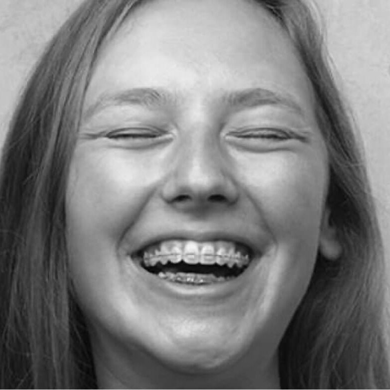 treatment-traditional-braces Biloxi Orthodontist